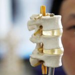 impression-3d-implants-vertebre-1