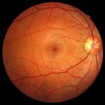 retina-eye_humanlab_1024