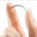 essure 1