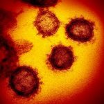 Coronavirus_NIH_Gallery